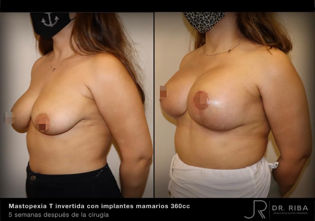 Jordi Riba Vilchez-51