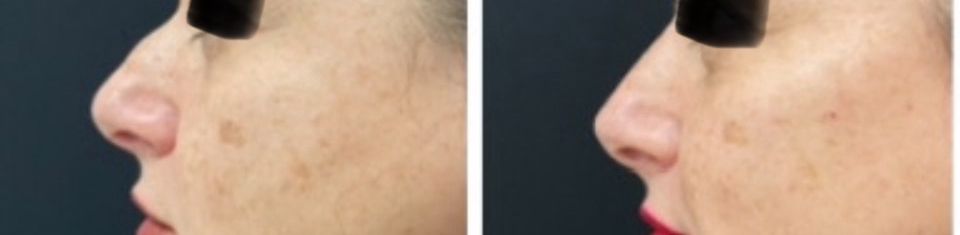 Silvia Melania Baio-22