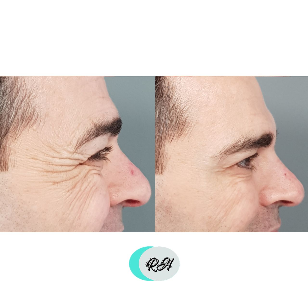 Rosalba Herrero Zerpa-175