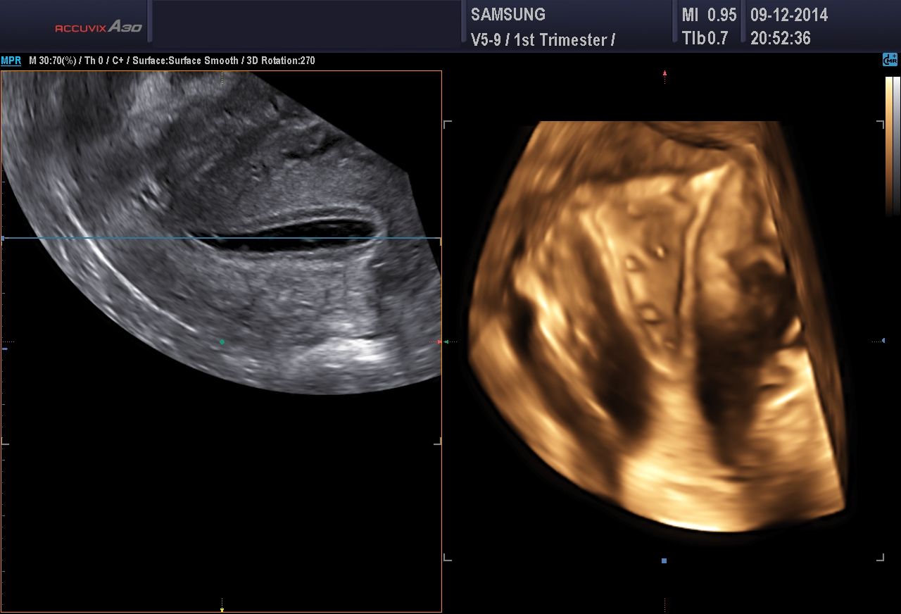 Antonio Claudio Cannizzaro-2