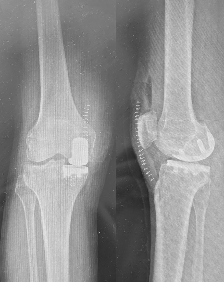 Alessandro Del Monaco-7