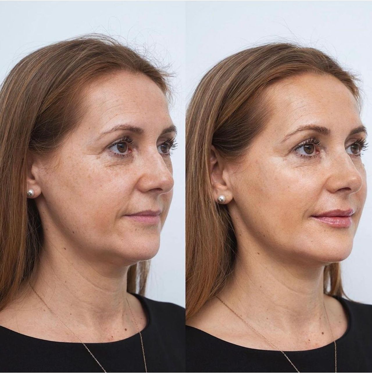 Raquel Moreno Pentinel-58