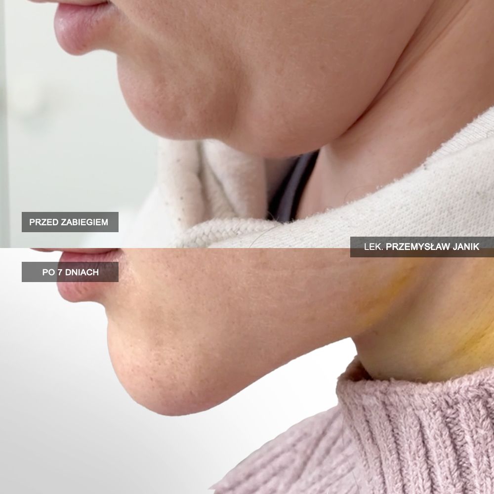 Przemysław Janik-26