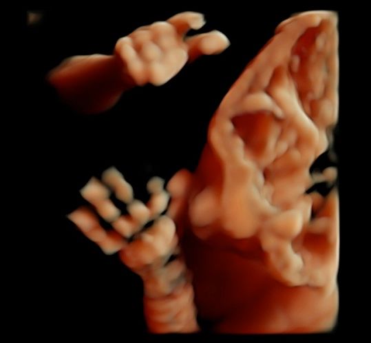 Tommaso Incandela-36