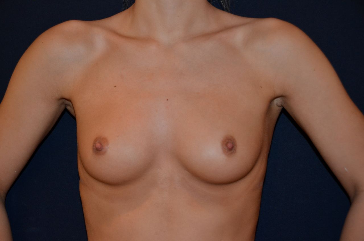 Christoffer Ingves-11