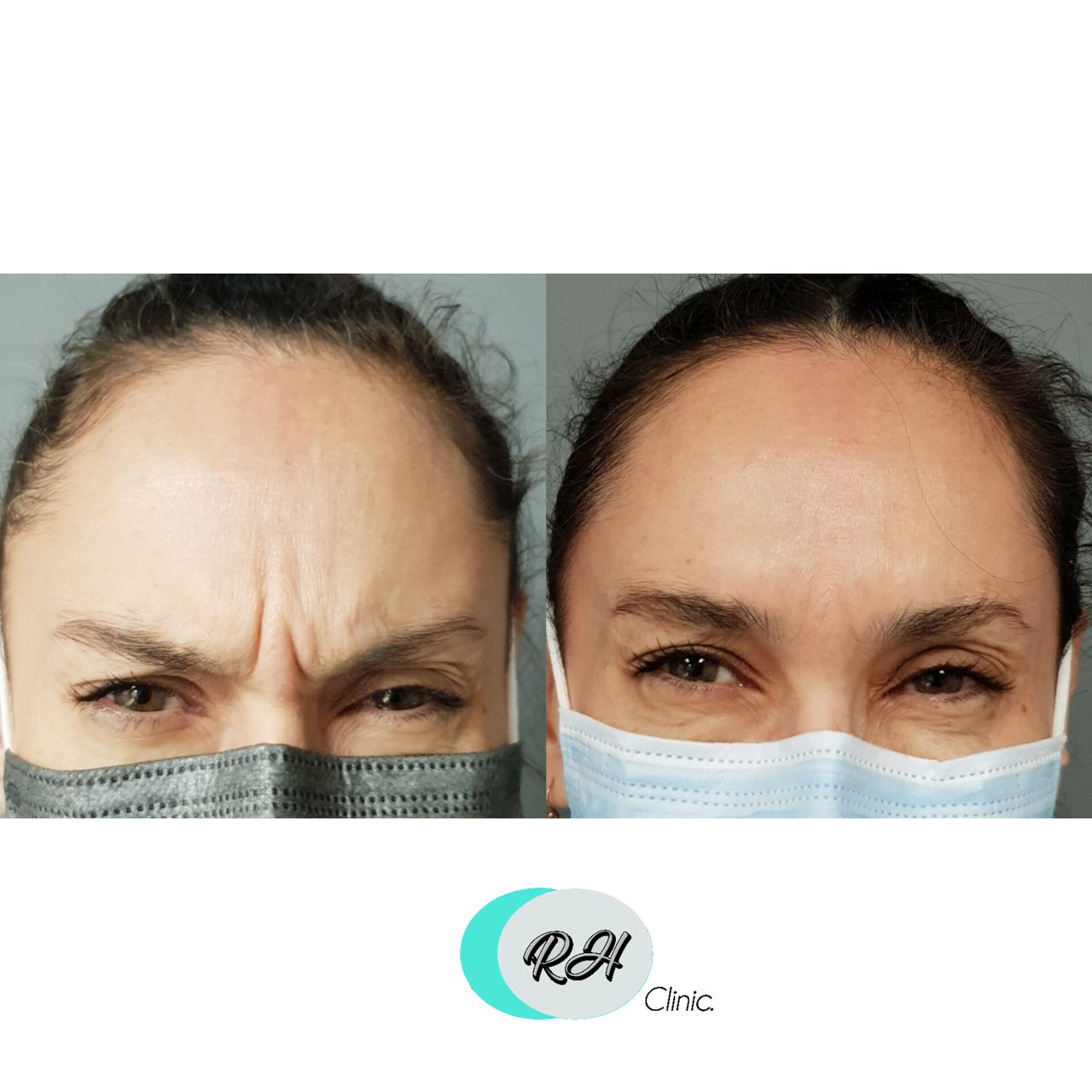 Rosalba Herrero Zerpa-73