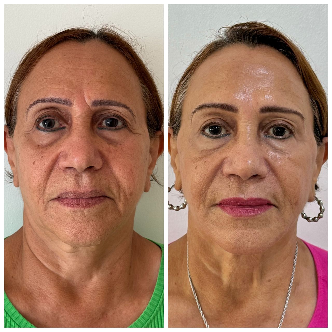 Camilo López Socarrás-26