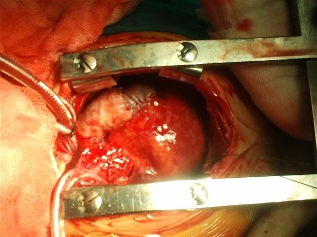 H. Hakan Poyrazoğlu-3