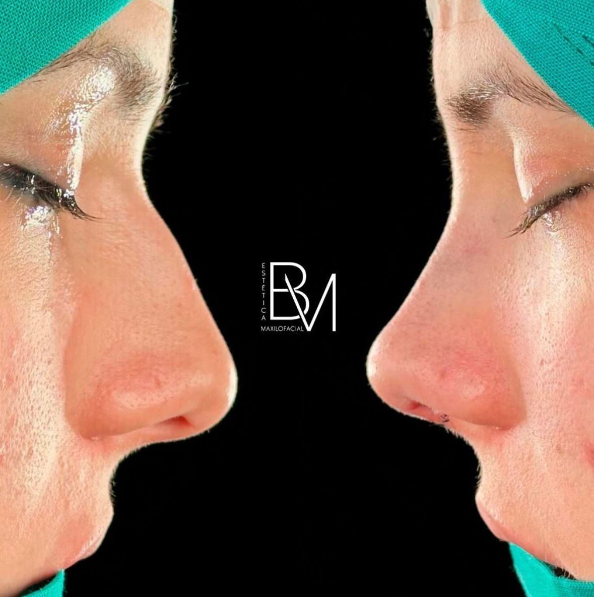 Beatriz Moralejo-26
