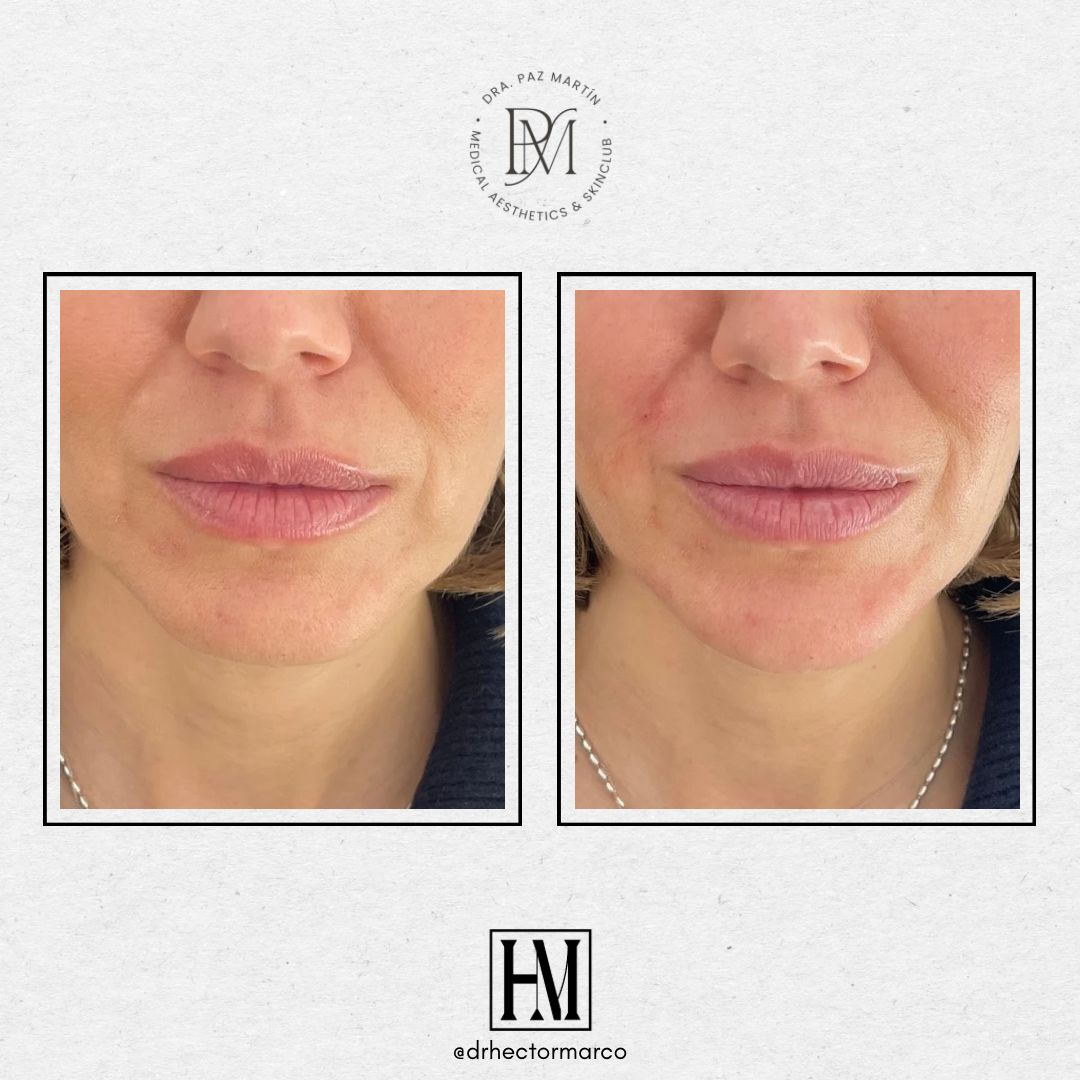 Héctor Marco Ruiz-5