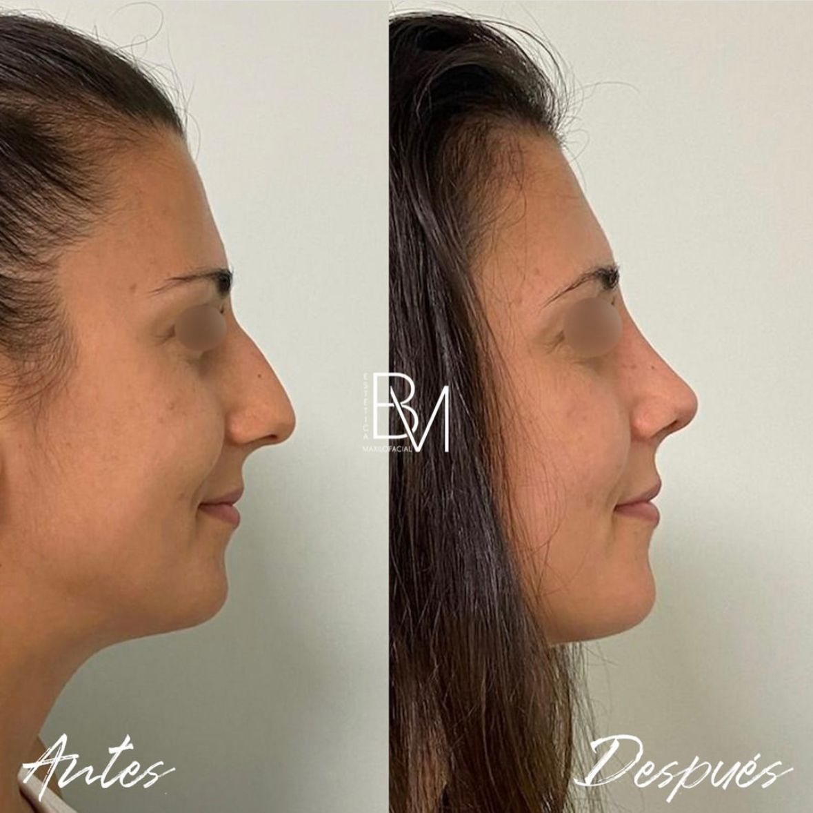 Beatriz Moralejo-36