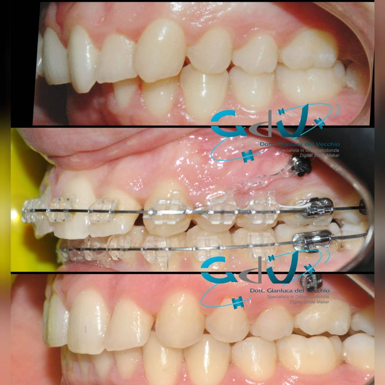 Gianluca Del Vecchio-132