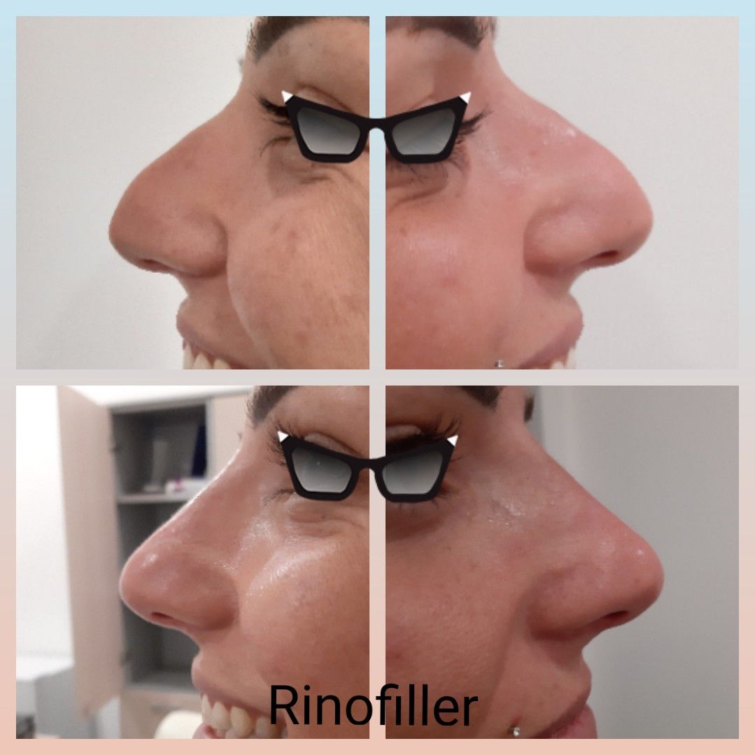 Paola Della Rocca-12