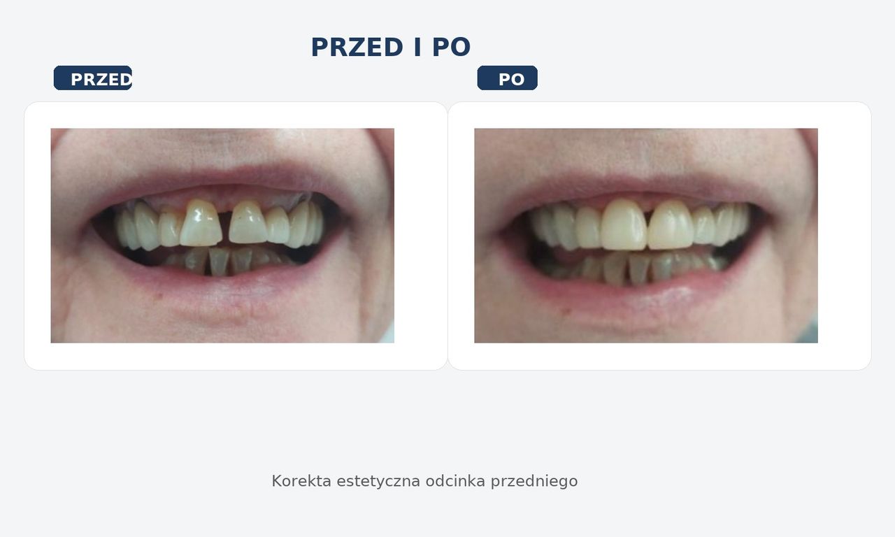 Izabela Osuch (Kulas)-3