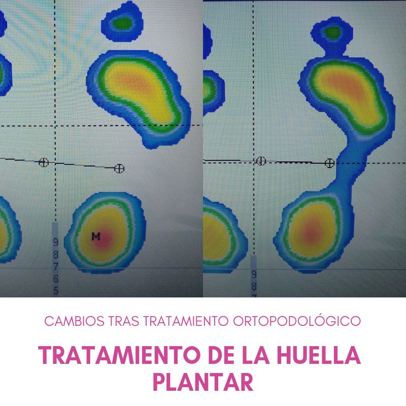 Salomé Antón Arnal-26