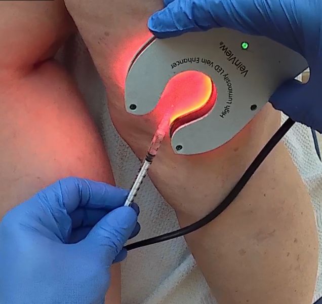 Ramiro Diego Abran-90