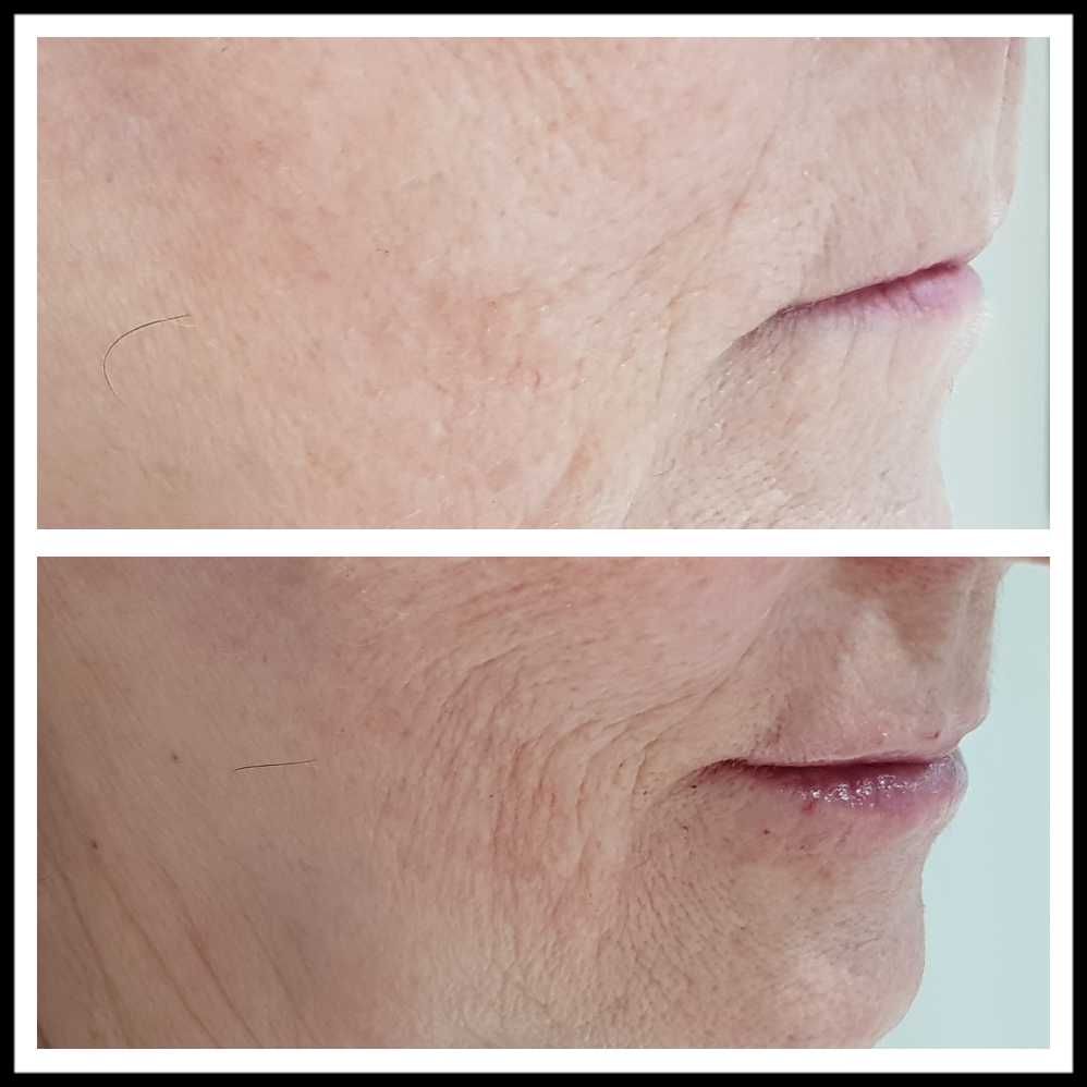 Rosalba Herrero Zerpa-297