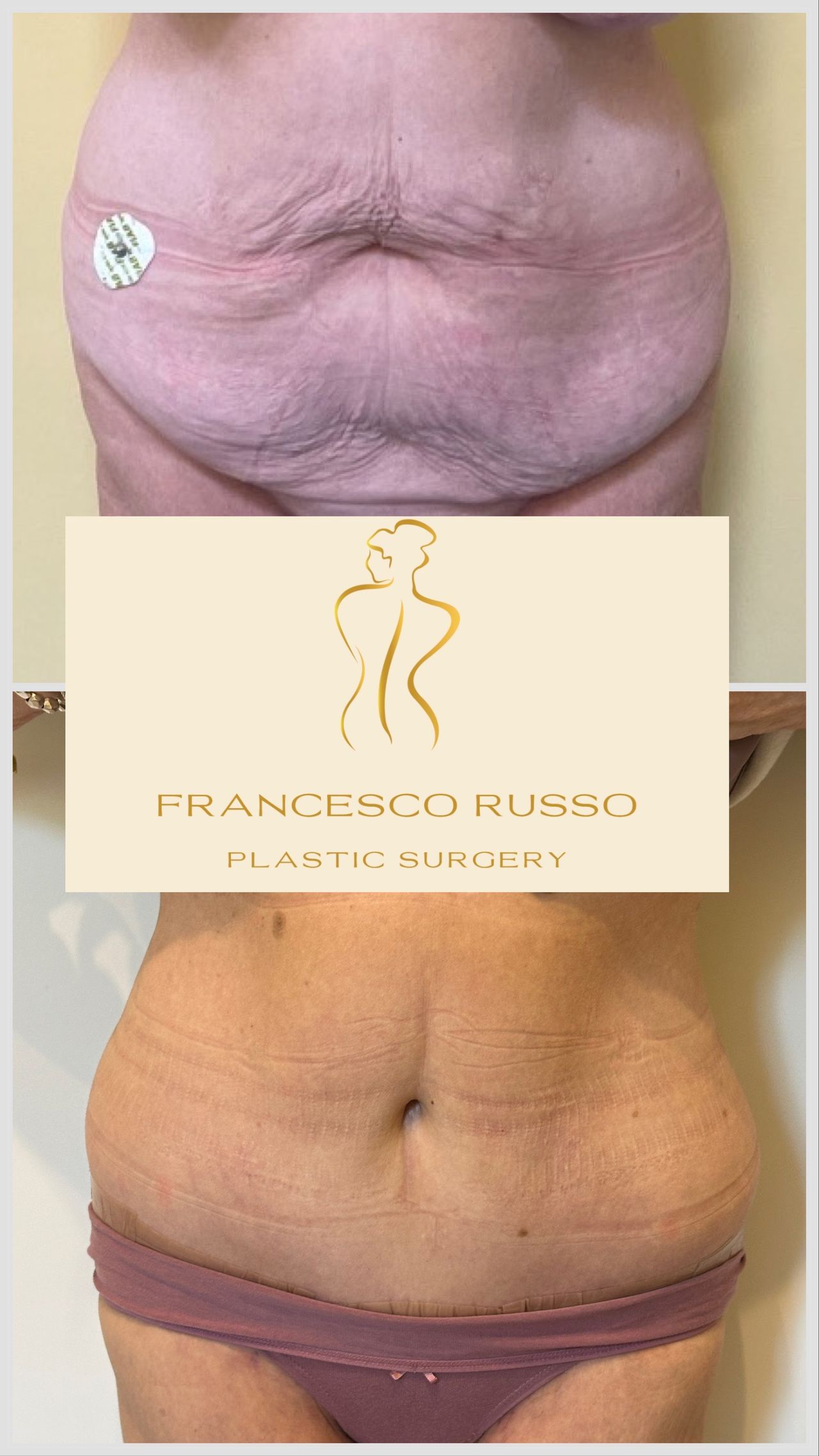 Francesco Russo-20