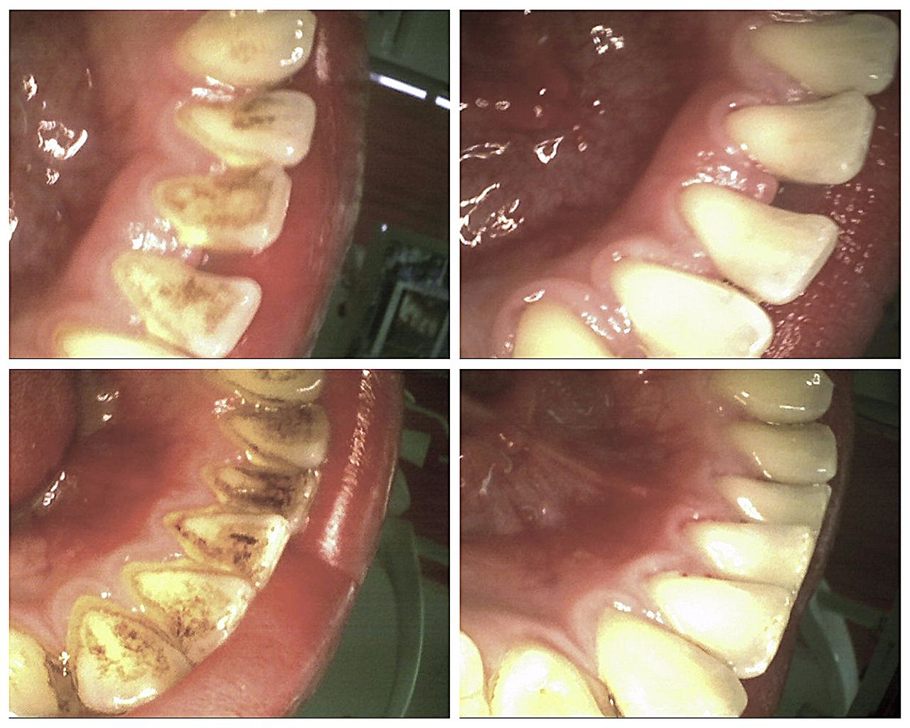 Katarzyna  Kmieć -6