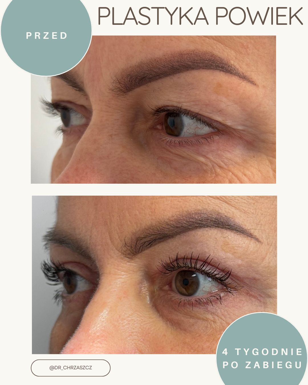 Michał Chrząszcz-5