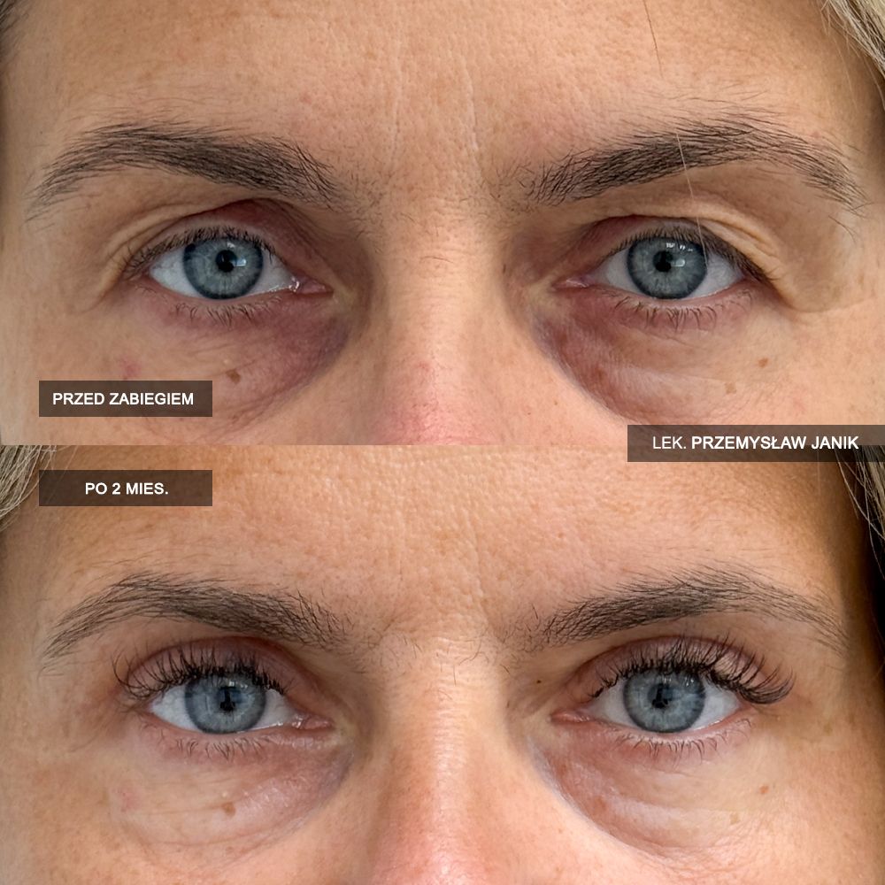 Przemysław Janik-56