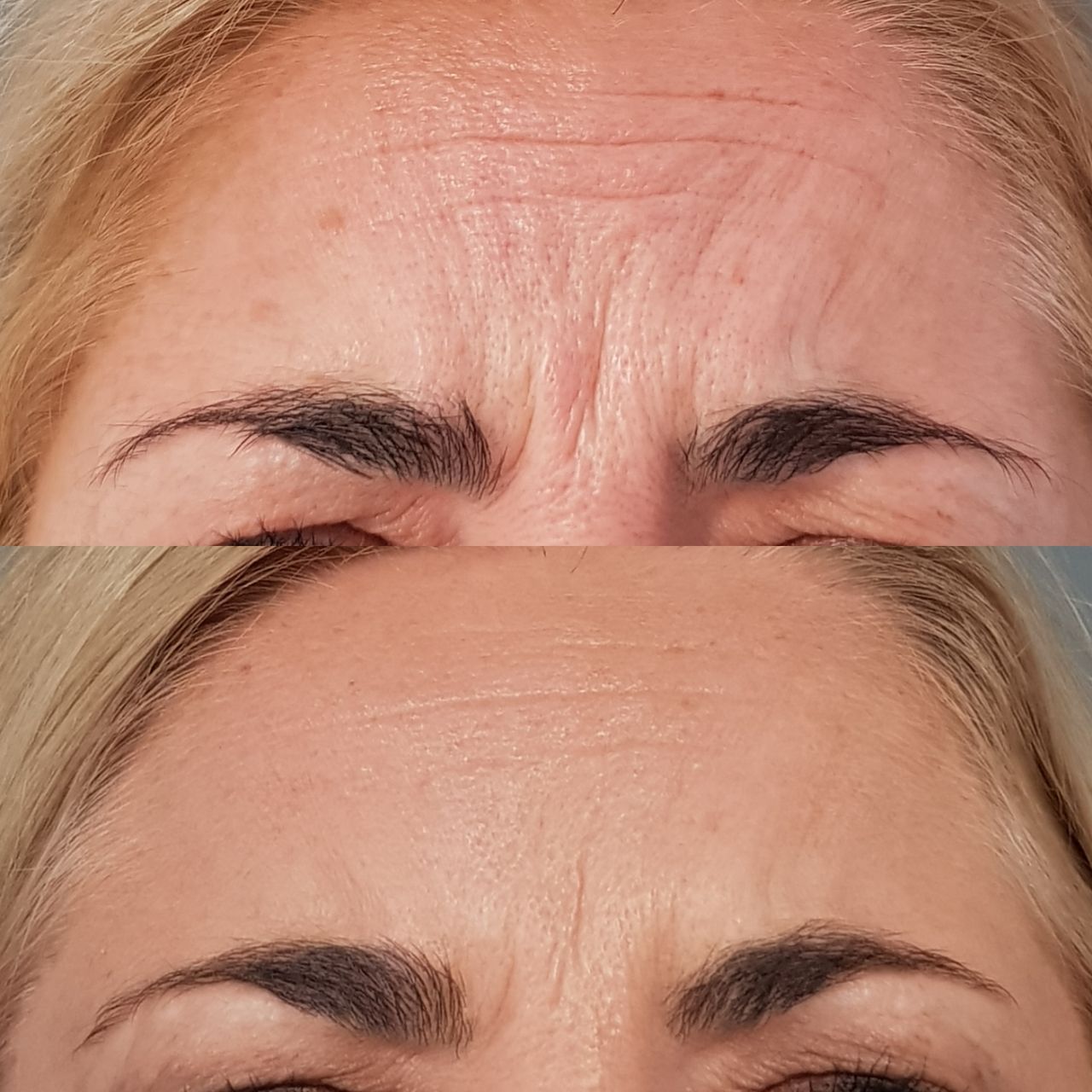 Rosalba Herrero Zerpa-242