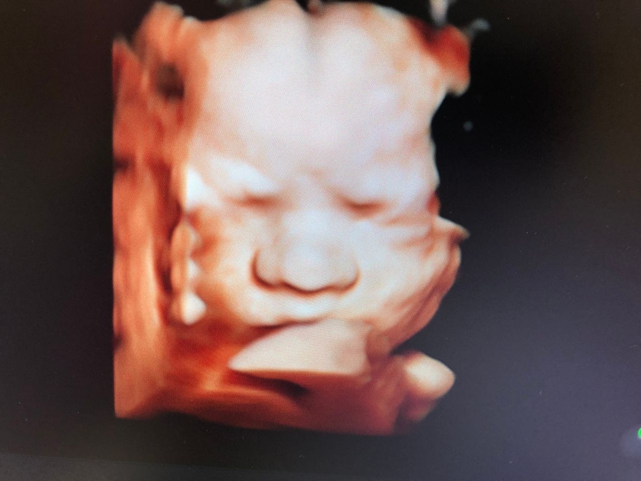 Katarzyna Leszczyńska-11