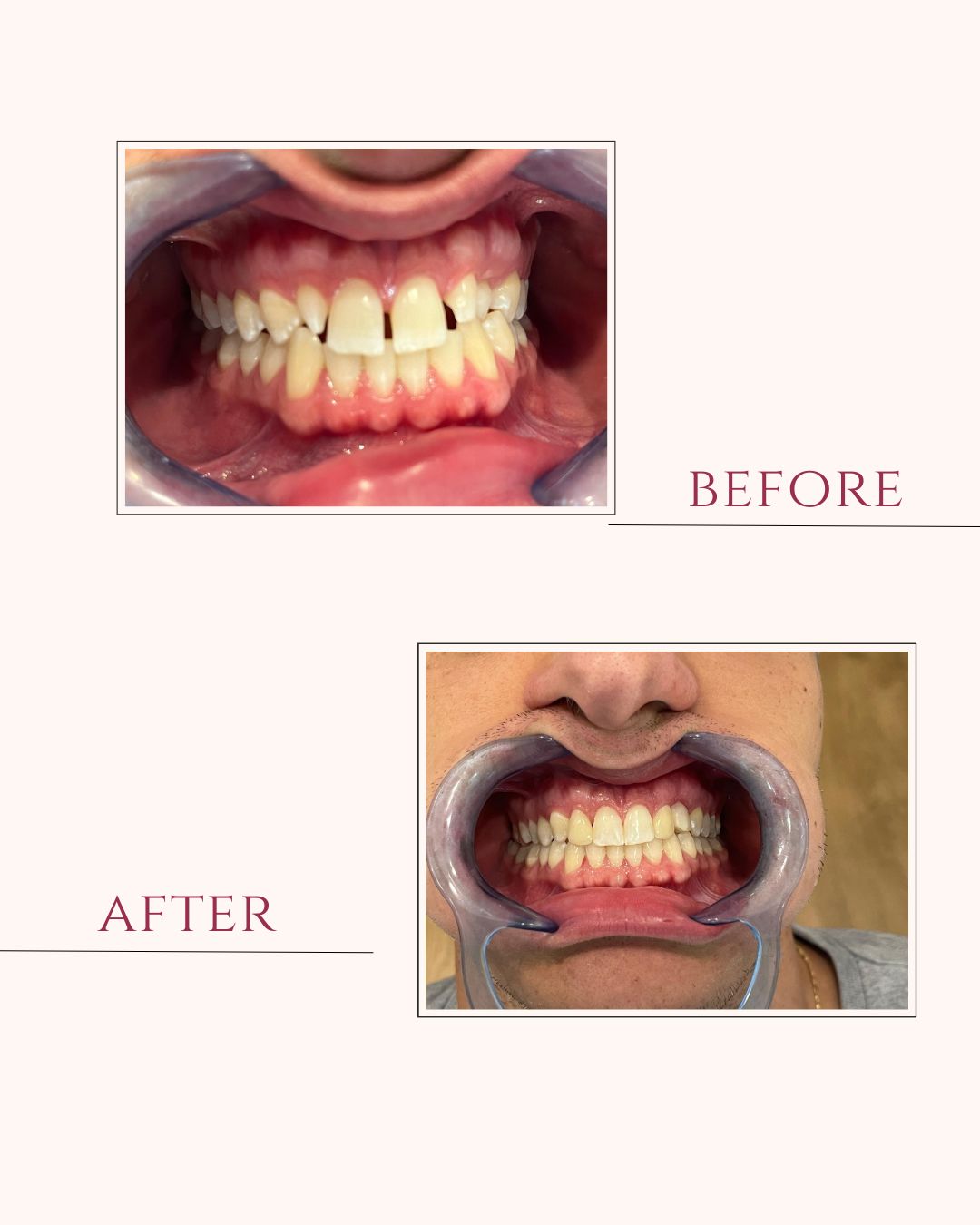 Riccardo Centofanti-8