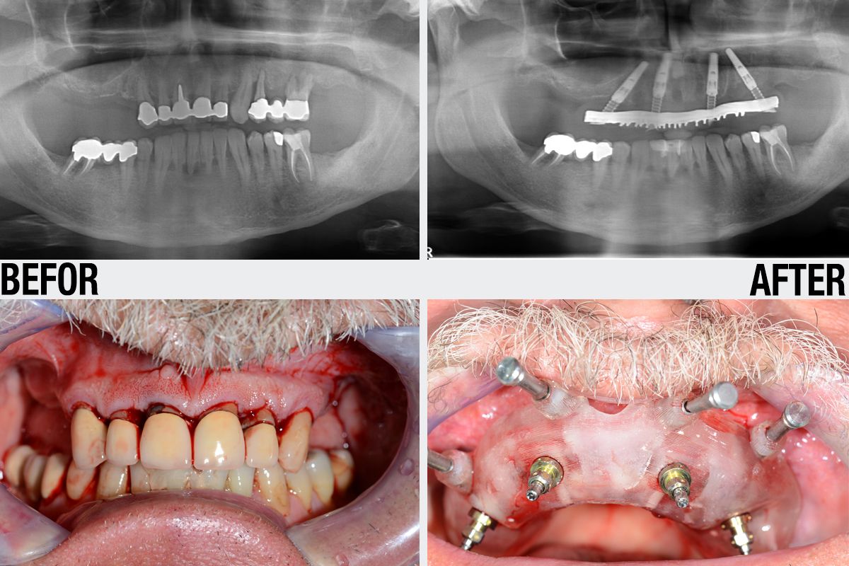 Alessandro Palumbo-29