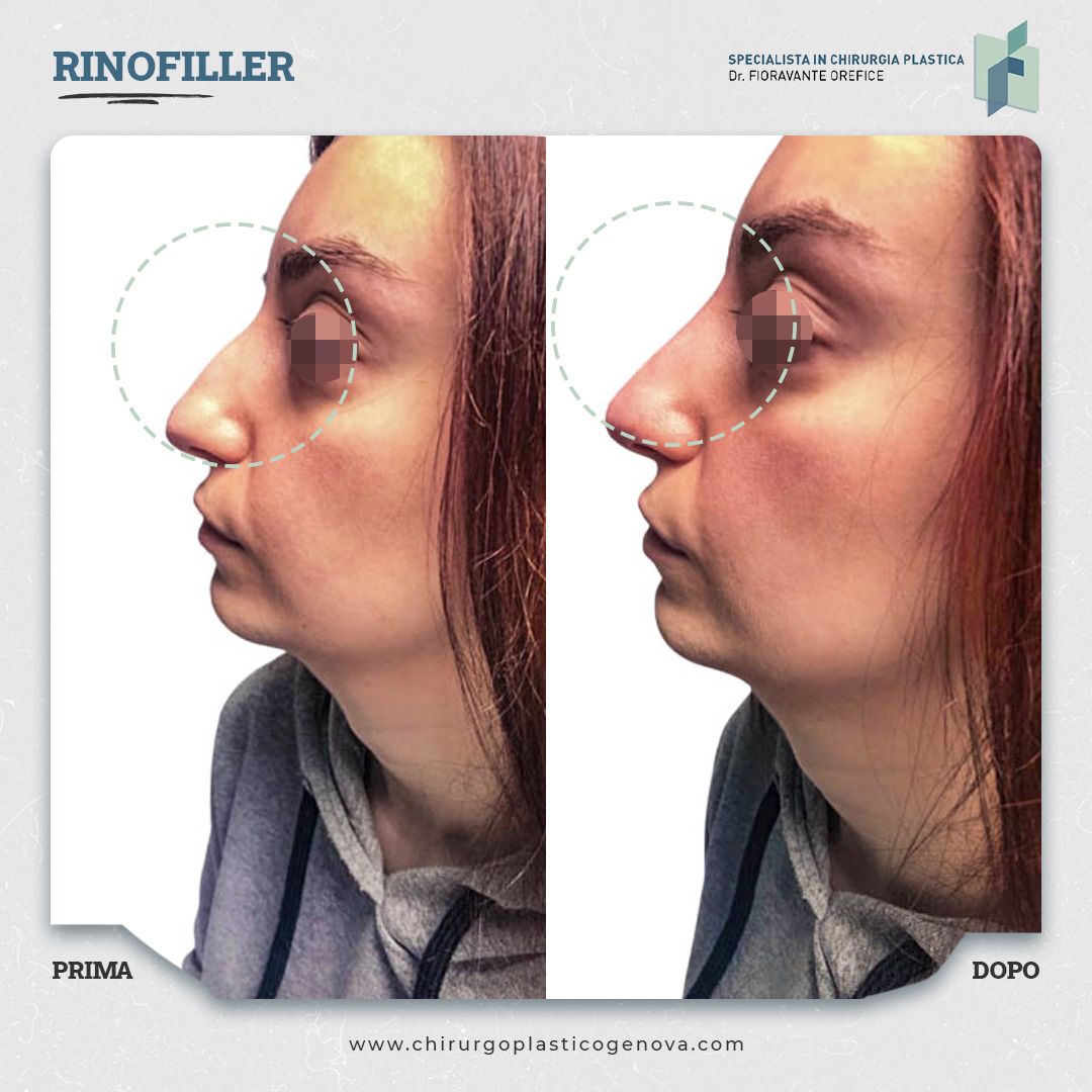 Fioravante Orefice-18