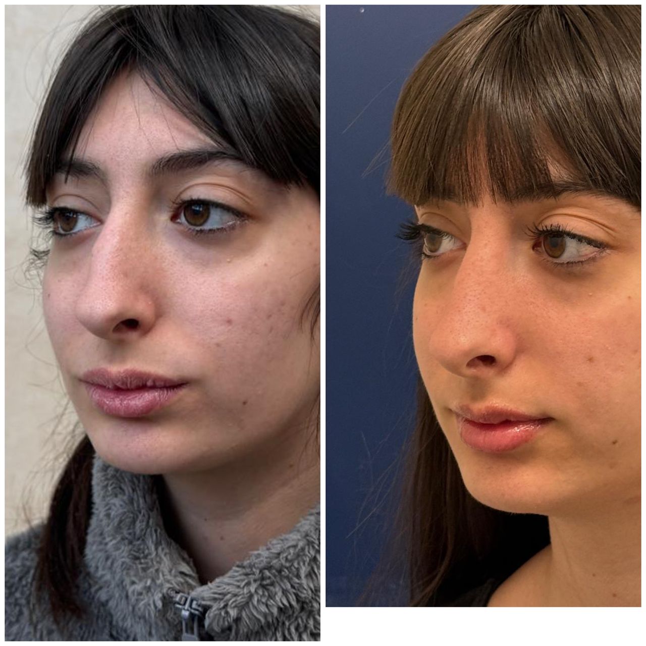 Maurizio Perugini-16