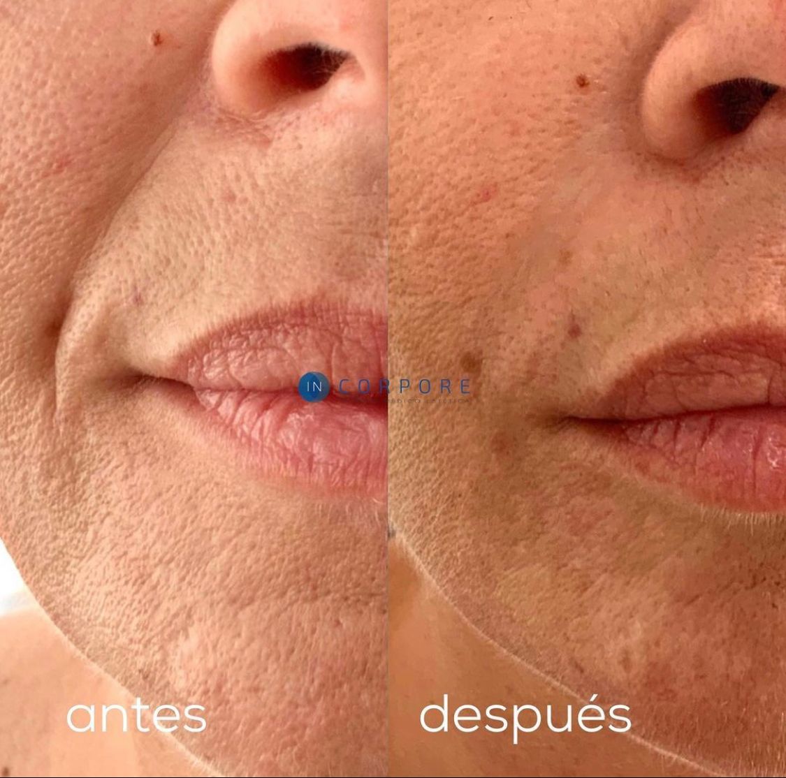 Juan Enrique Pérez Enríquez-4