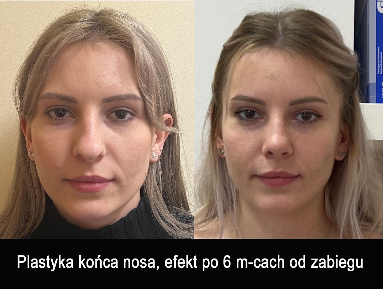 Mariusz Zagajewski-35