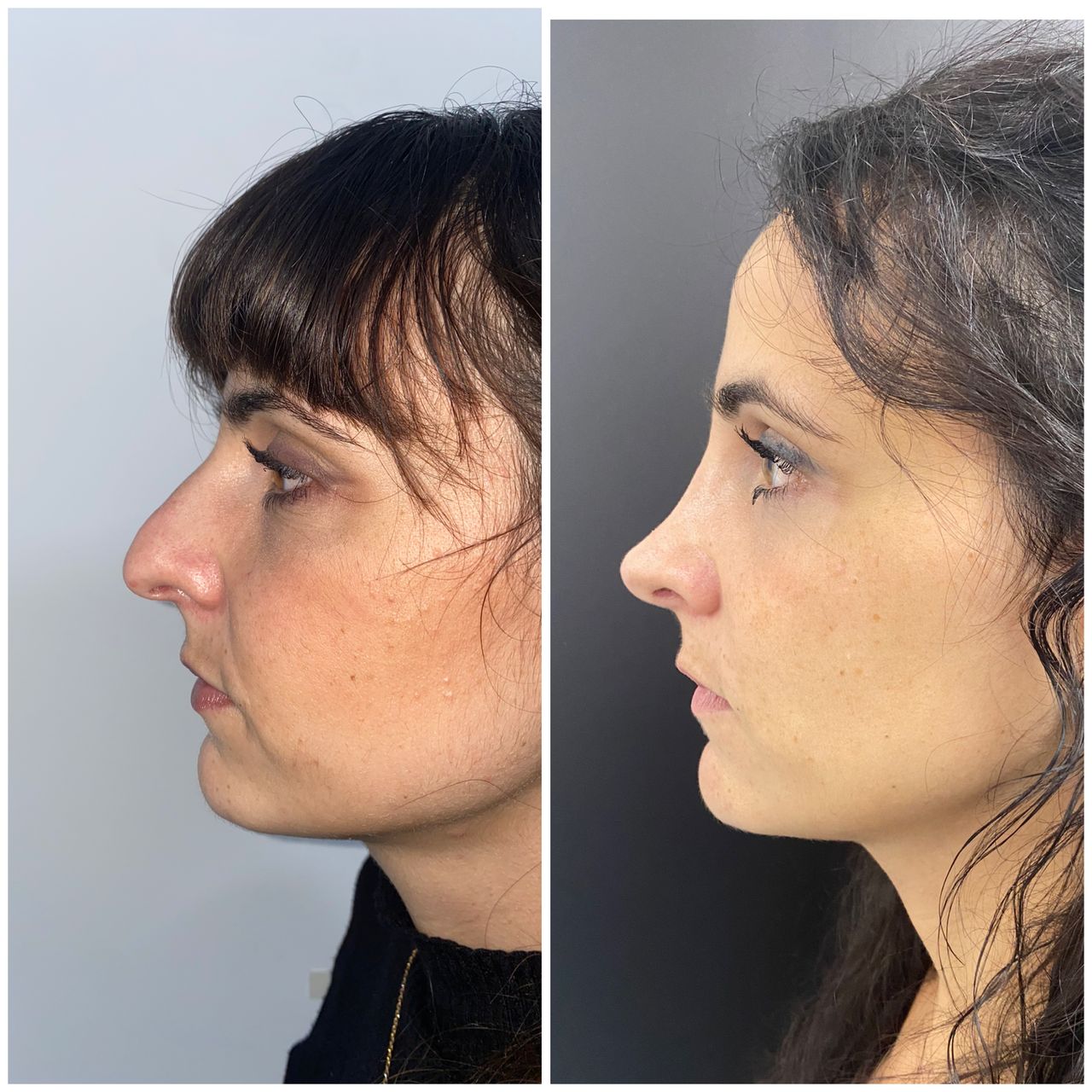 Maurizio Perugini-15