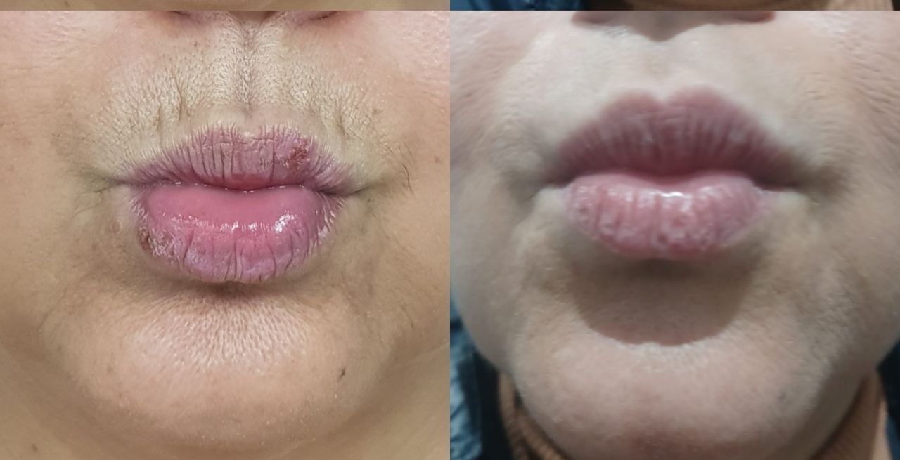 Rosalba Herrero Zerpa-63