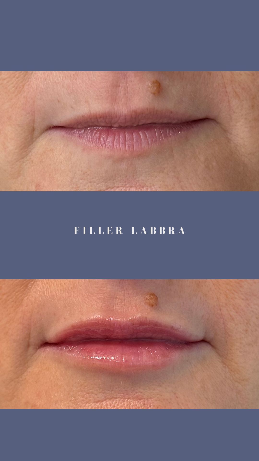 Federica Di Ruscio-34