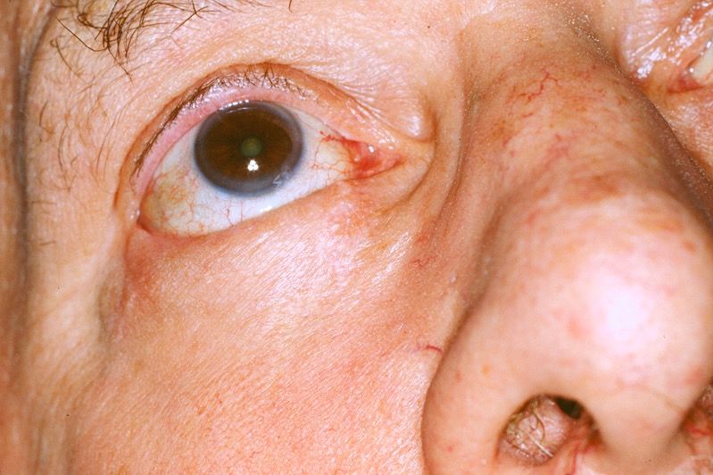 Franco Buttafarro-22