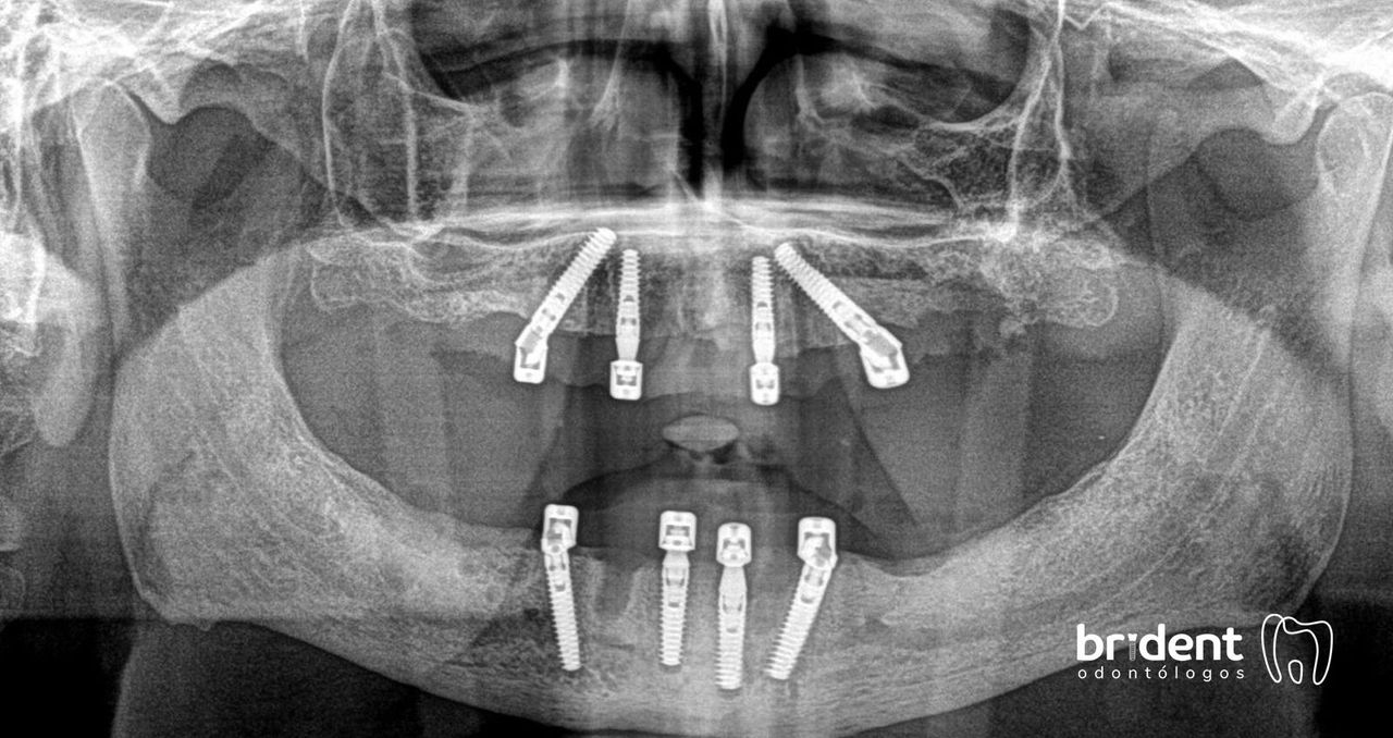 Guillermo Moreno Fragoso-36