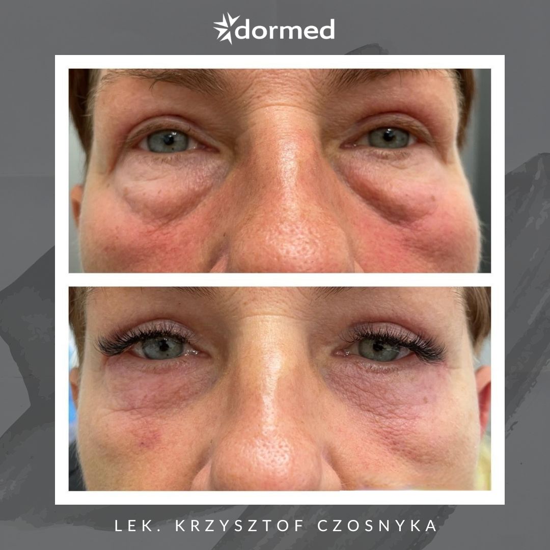 Krzysztof Czosnyka-4