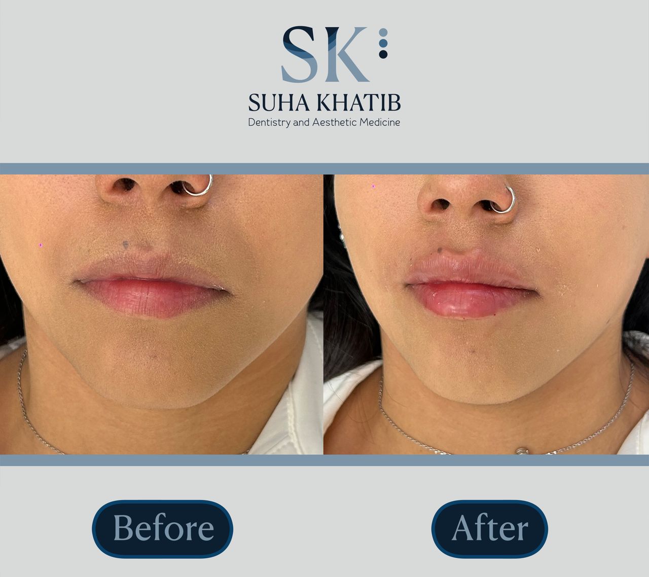 Suha Khatib-17