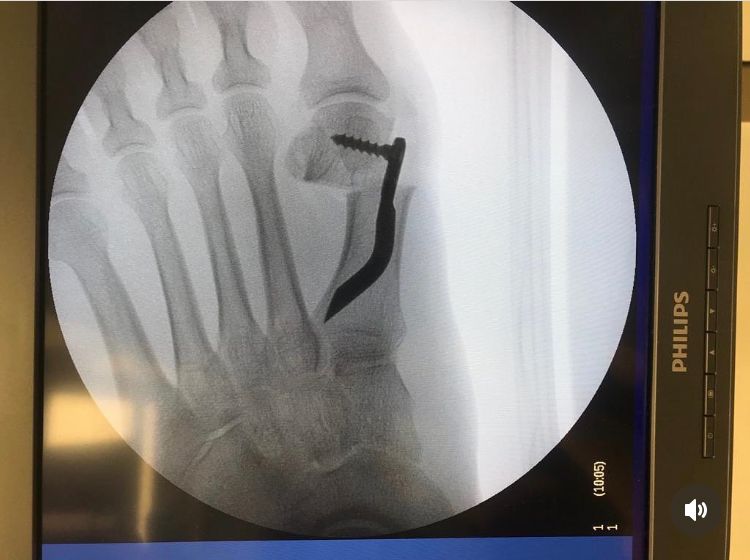 Ernesto Galán Fernández-7