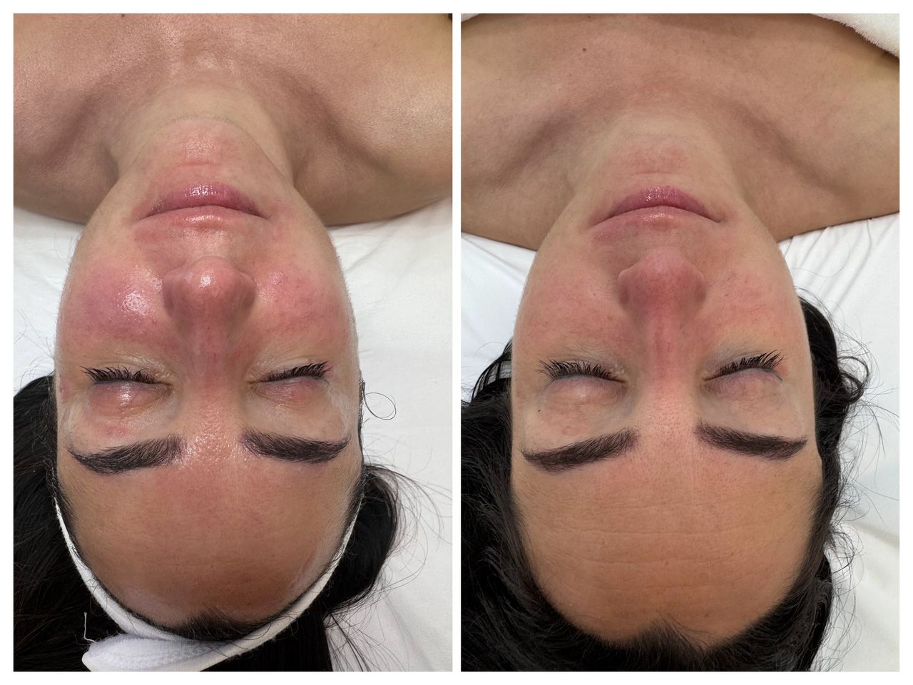 Yolimar Acevedo Raya-2