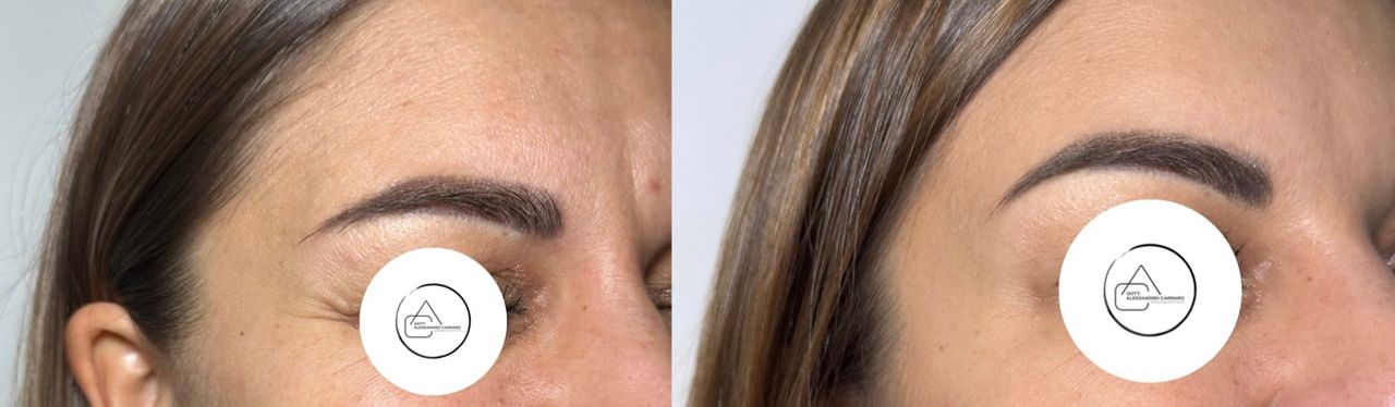 Alessandro Carraro-10