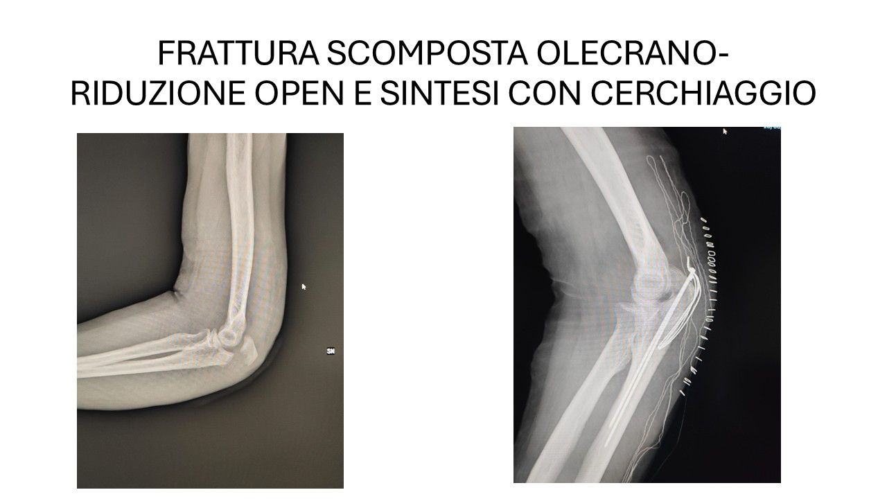 Bartolomeo D'amora-12