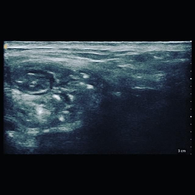 Jacopo Pettinelli-12