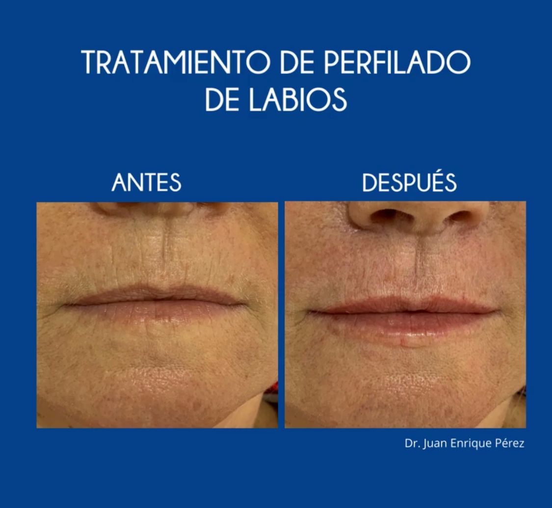 Juan Enrique Pérez Enríquez-40