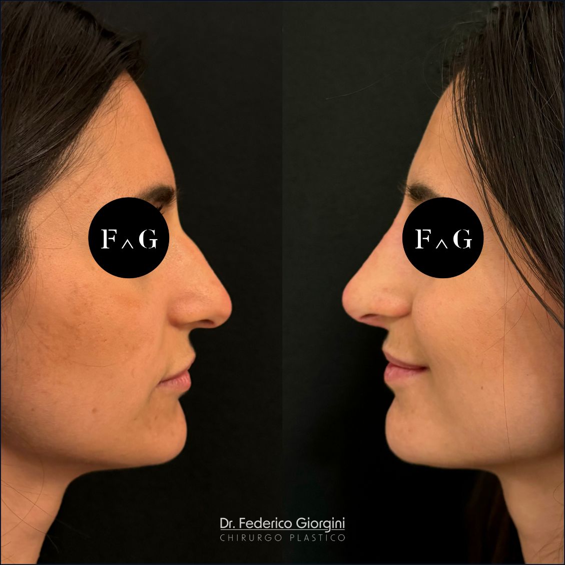 Federico Giorgini-32