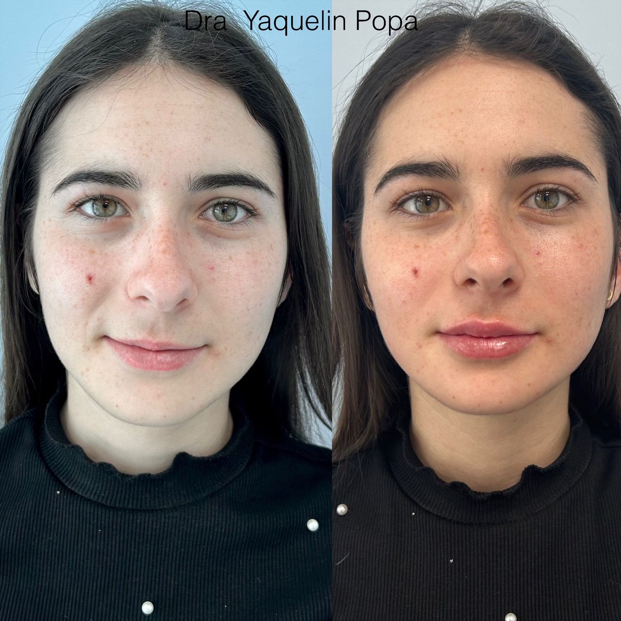 Yaquelin Popa Rosales-7