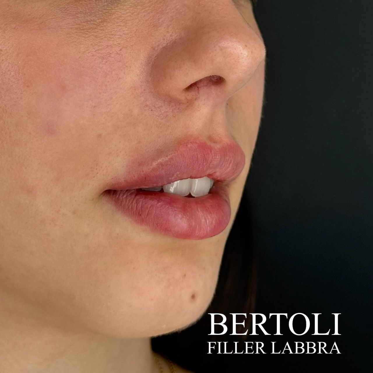 Andrea Bertoli-9