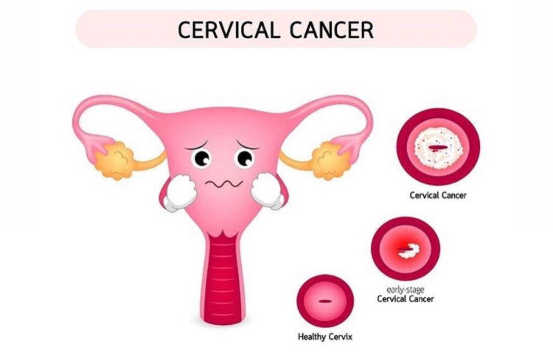 Vincenzo Massimo Prestia-15